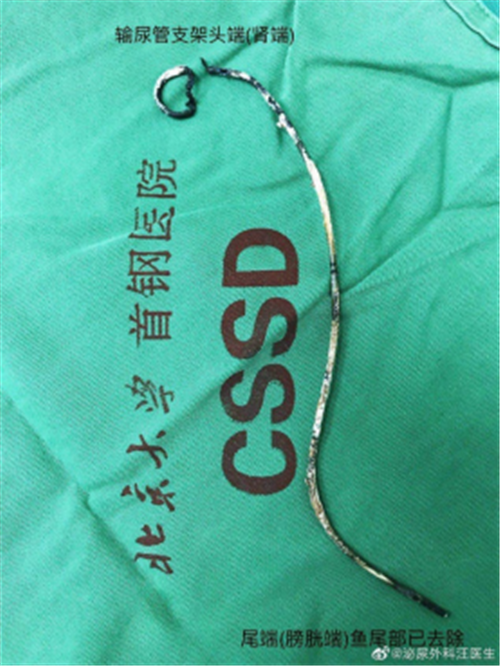 疯狂的石头消失了956.png