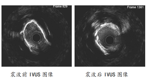 微信截图_20230414134624.png