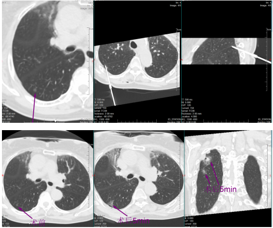 ef7e35130cb04cb5a6e99417189b2ca5